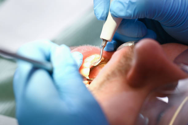 Best Emergency Broken Tooth Repair in Chauvin, LA