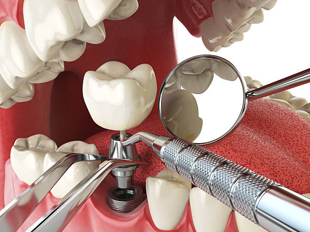 Best Emergency Dental Surgery in Chauvin, LA